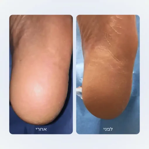 קרם טיפולי לרגליים | Kamedis CALM – תמונה 2